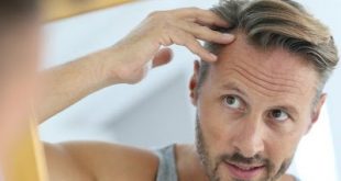Μεταμόσχευση μαλλιών: Η νέα επαναστατική τεχνική FUE