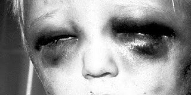 Απαράδεκτες ελλείψεις στη διερεύνηση της παιδικής κακοποίησης. Σε παιδιατρικά νοσοκομεία δεν υπάρχουν ιατροδικαστές!