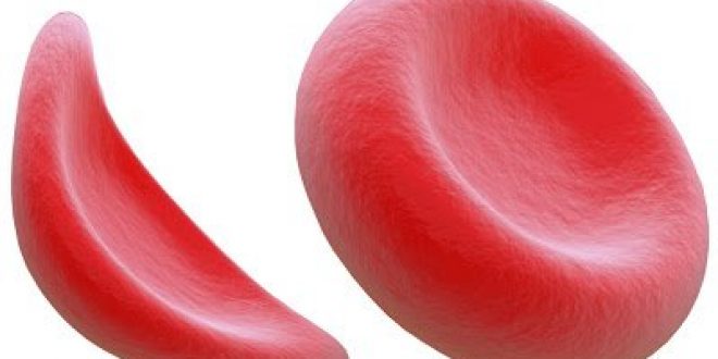 Παγκόσμια Ημέρα Δρεπανοκυτταρικής Νόσου, 19 Ιουνίου