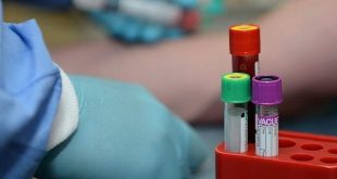 Τεστ αίματος ανιχνεύει 10 τύπους καρκίνου, χρόνια πριν εκδηλωθούν