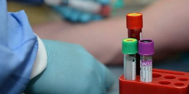 Τεστ αίματος ανιχνεύει 10 τύπους καρκίνου, χρόνια πριν εκδηλωθούν