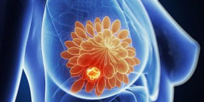 Το φάρμακο pertuzumab πήρε έγκριση για τον καρκίνο του μαστού